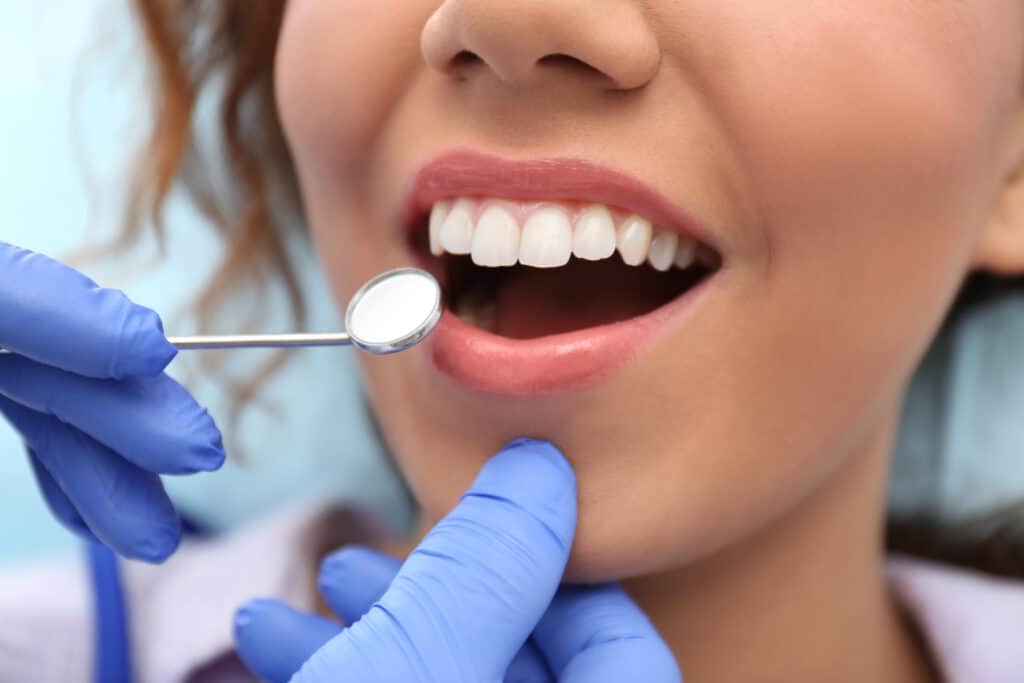 Teeth whitening vacaville